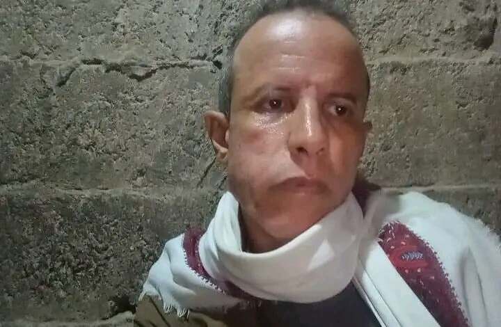 الإفراج عن الصحفي محمد الصهباني بعد 12 يوماً من الاختطاف في سجون الحوثيين